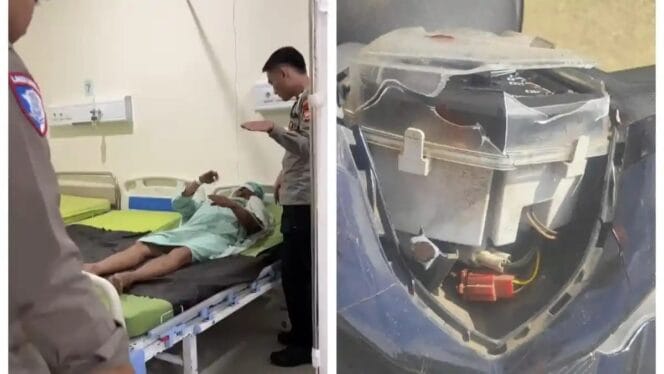 
Dugaan Tabrak Lari Disengaja di Bengkulu, Petugas Keamanan Luka Parah dan Harus Dioperasi