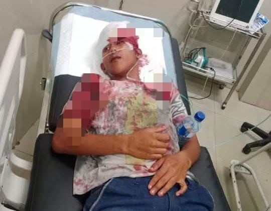 Aksi Geng Motor di Bengkulu Kembali Memakan Korban: Dua Pemuda Terluka Parah di Rawa Makmur