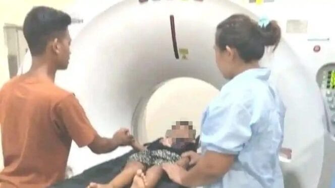 
Kondisi Memprihatinkan Bocah Korban Penculikan di Rejang Lebong: Diduga Alami Pendarahan Otak