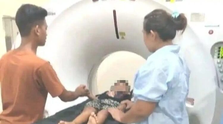 Kondisi Memprihatinkan Bocah Korban Penculikan di Rejang Lebong: Diduga Alami Pendarahan Otak